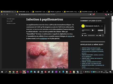 Infecție cu papilomavirus cum să tratezi