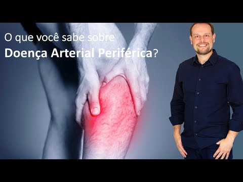 Doença Arterial Periférica: o que você sabe sobre?