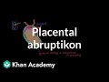 Placental abruption | Reproductive system physiology | NCLEX-RN | Khan Academy