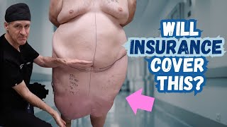The Difference Between a Panniculectomy and Tummy Tuck - Insurance vs. Aesthetics