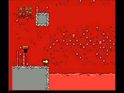 M.C. Kids 6-4 Another Glitch