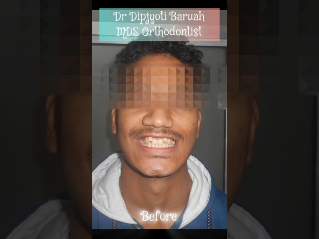 Thumbnail for Post ID: 79YKYcokxlk