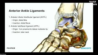 Using Ultrasound to Evaluate the Anterior Ankle