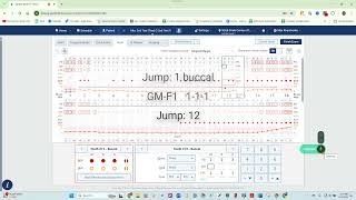 Denti.AI Voice Perio for Dentrix Ascend