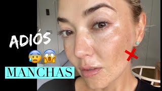 COMO LOGRE CONTROLAR Y DISMINUIR LAS MANCHAS EN MI PIEL ! | Aleja Franco | The Beauty Surfer