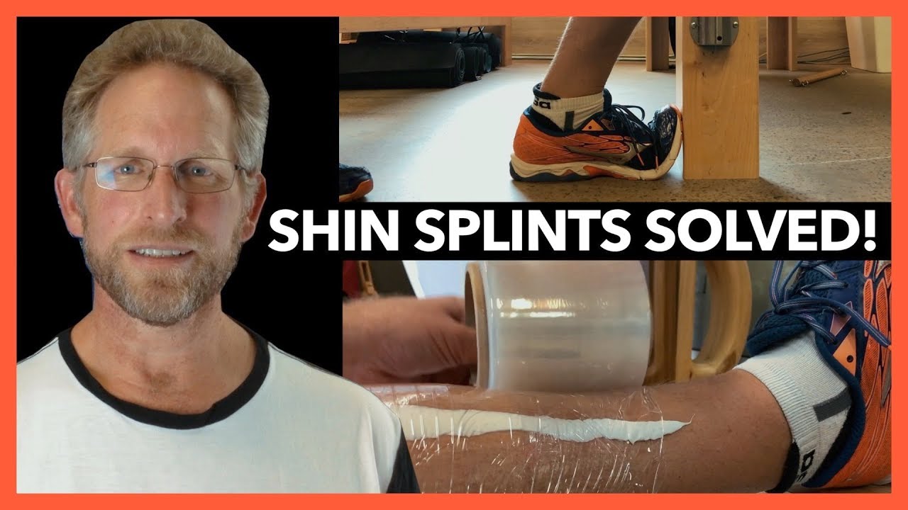 Shin Splints Explained: Medial Tibial Stress Syndrome (MTSS), Cause, Physio, Exercises and Rehab