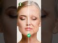5 Amazing Health Benefits Of Pistachios Health Benefits Of Pista Pistachios Health Benefits