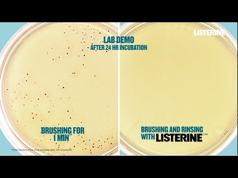 LISTERINE® Lab Demo Results – The power of Listerine for a 3 times healthier gums