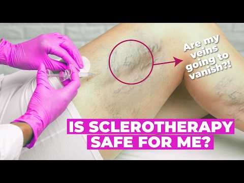 Is Sclerotherapy Safe? Risks, Benefits & What to Expect