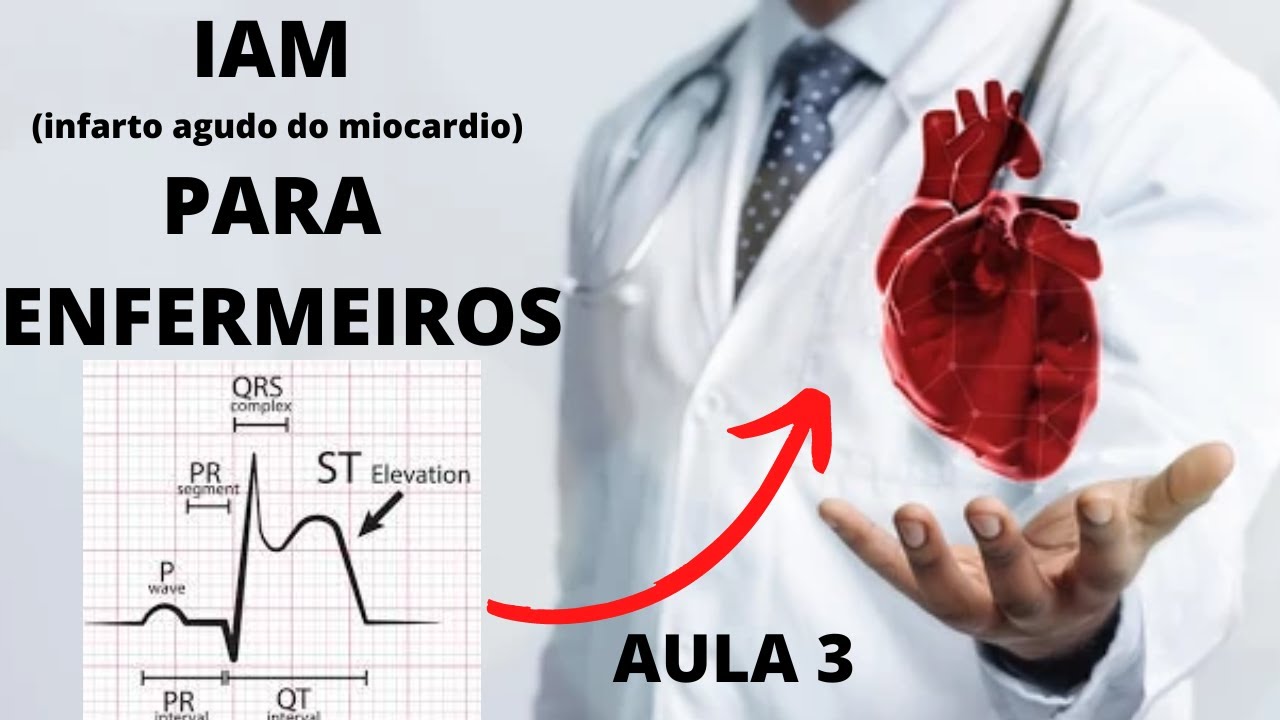 Aula 3 IAM com Supra ST - Principais medicações usadas no IAM com supra de ST