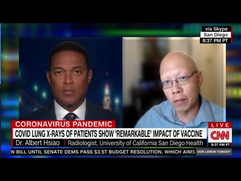 CNN Don Lemon Vaccination and X-rays