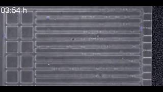 Spontaneous motility _ detail