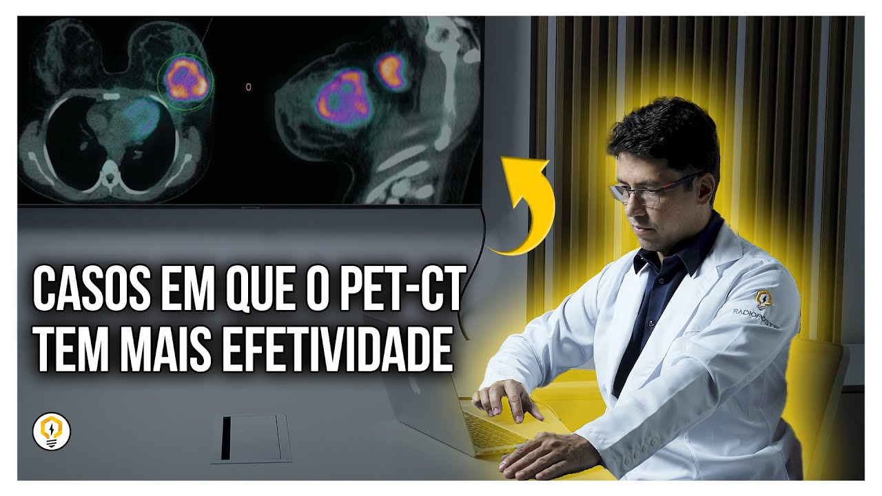 PET-CT NO CÂNCER DE MAMA (para Radiologistas) - Parte 1