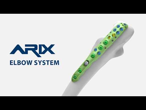 [ARIX OS] ARIX Elbow - Olecranon Surgical Guide
