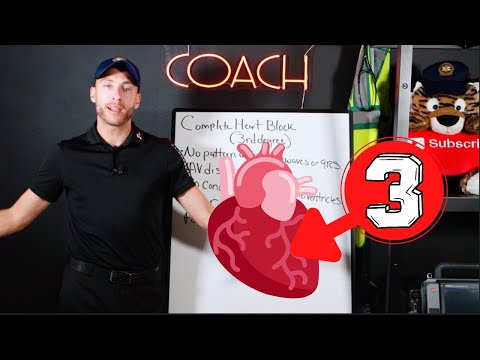 UNDERSTAND 3rd Degree Heart Block