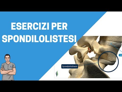 Pomata per il mal di schiena Articolazioni doloranti dei piedi e la temperatura