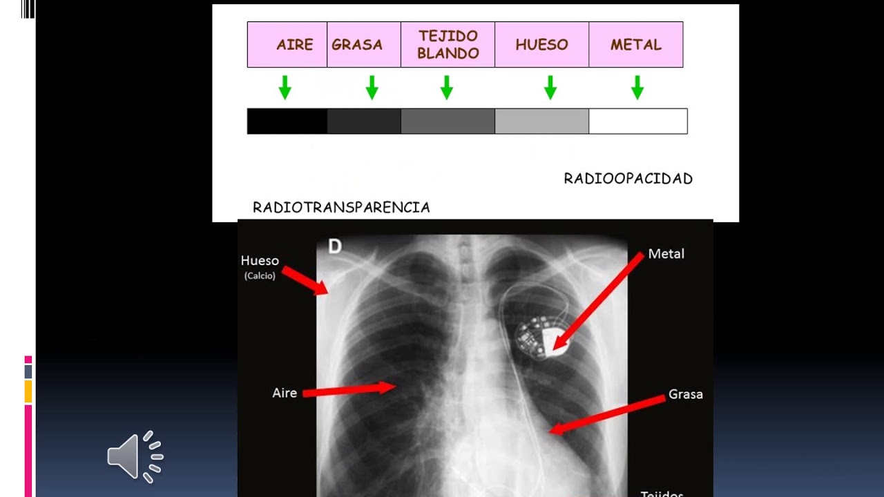 DIAGNÓSTICO POR IMÁGENES, Fundamentos