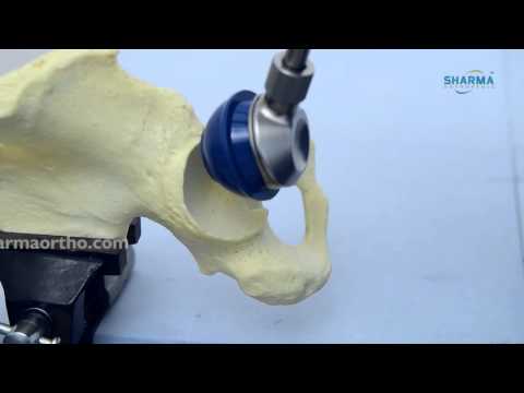 Total Hip Replacement System- Cemented | Hip Replacement