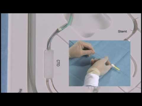 Angioplasty technique: an antegrade approach for CTO (+English subtitle)