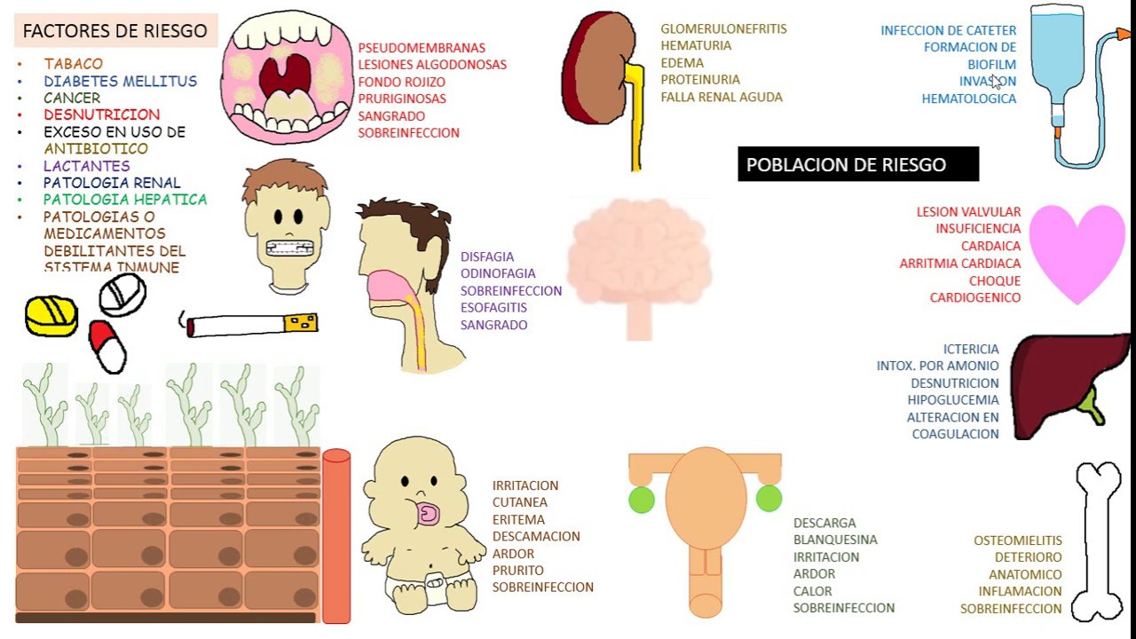 Candida albicans, Candidiasis