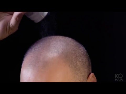 KÖ-HAIR FIBERS Haarverdichter, Schütthaar, Streuhaar für lichtes Haar und Teilglatze