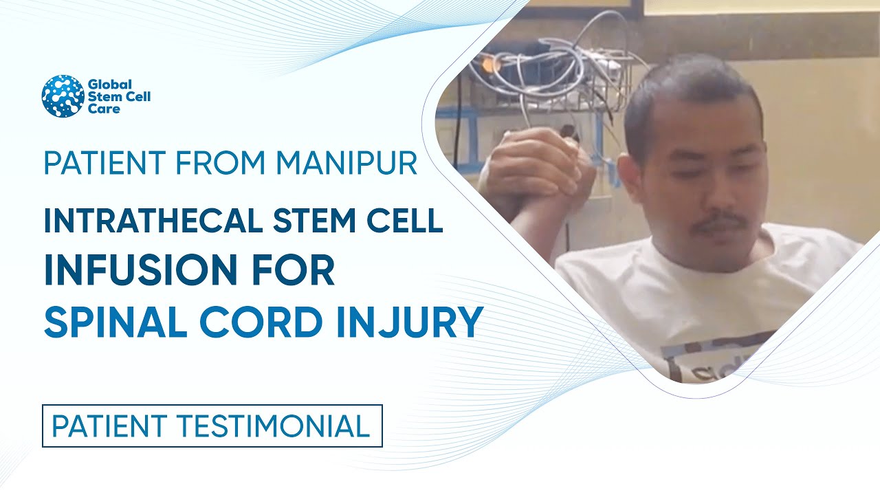  0:45 Now playing  Watch later Add to queue "MANIPUR Patient's Remarkable Recovery with Intrathecal Stem Cell Infusion for Spinal Cord Injury"