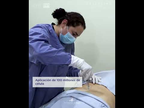 Repairing Spinal Bone Erosion with Mesenchymal Stem Cell Treatment in Mexico
