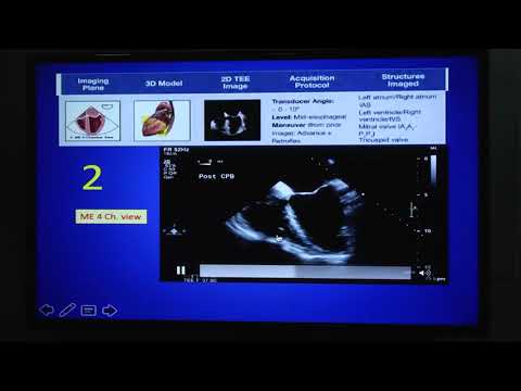 20180820_1_Comprehensive TEE _Unnikrishnan_KP_DR