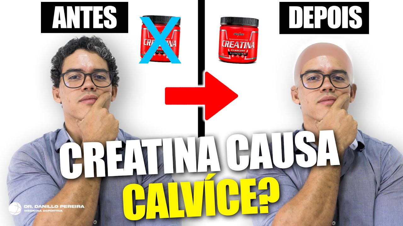 CREATINA CAUSA QUEDA DE CABELO? VOCÊ VAI FICAR CALVO?