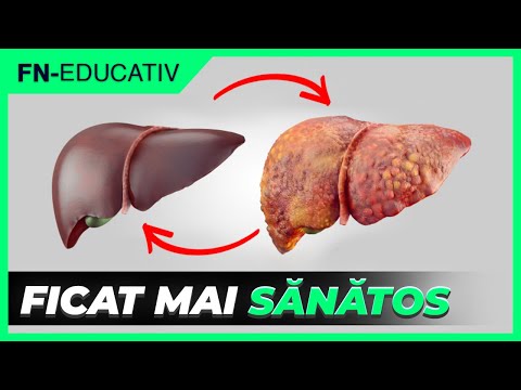 Ce sa Mananci daca ai Ficatul Gras | Top Alimente