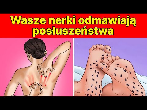 8 NIEZWYKŁYCH oznak, że Twoje nerki wołają o pomoc