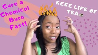 HOW TO HEAL A RELAXER CHEMICAL BURN FAST: Avoid chemical burns on the scalp