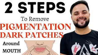 2 STEPS to Remove Pigmentation & Dark Patches around Mouth