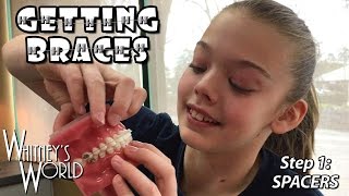 Whitney is Getting Braces! | Step 1 Spacers