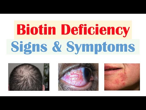 Biotin (Vit B7) Deficiency Signs & Symptoms (& Why They Occur)