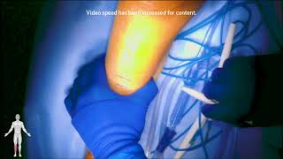 &quot;BKA&quot; (Maham Rahimi, MD, and Erica Xue, MD)