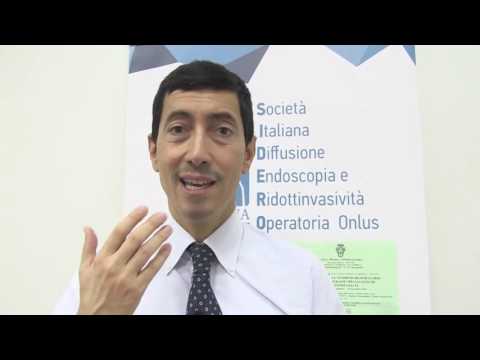 Trattamento completo per lartrosi del ginocchio Ridurre articolazioni della spalla infiammazione