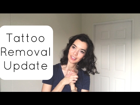 Tattoo Removal Update #2