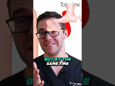 How to Cure Plantar Fasciitis in One Week Treatment Therapies