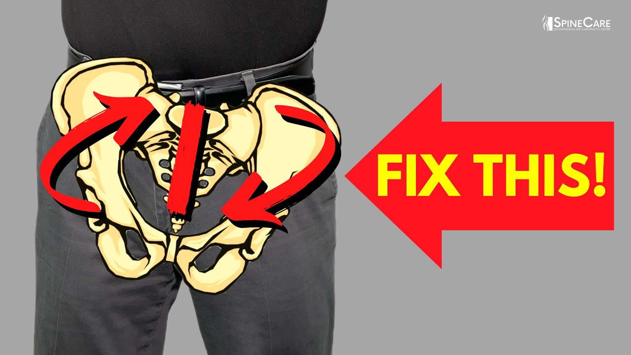 How to Fix a Rotated Pelvis in SECONDS