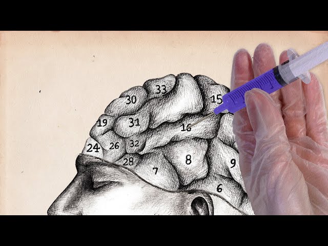 Vídeo relacionado con Histoire de la phrénologie