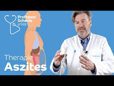 Behandlungsmöglichkeiten von Aszites - Professor Scheule erklärt einfach