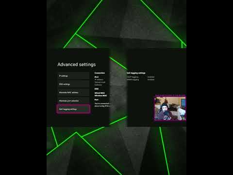 How to make your Xbox Internet connection faster in 60 seconds or less