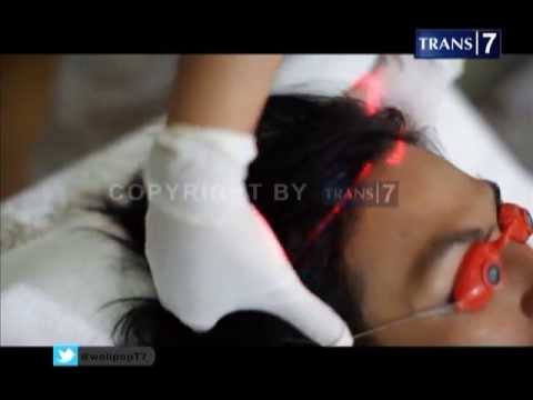 download lagu mp3 mp4 Tips Cantik Wolipop, download lagu Tips Cantik Wolipop gratis, unduh video klip Tips Cantik Wolipop