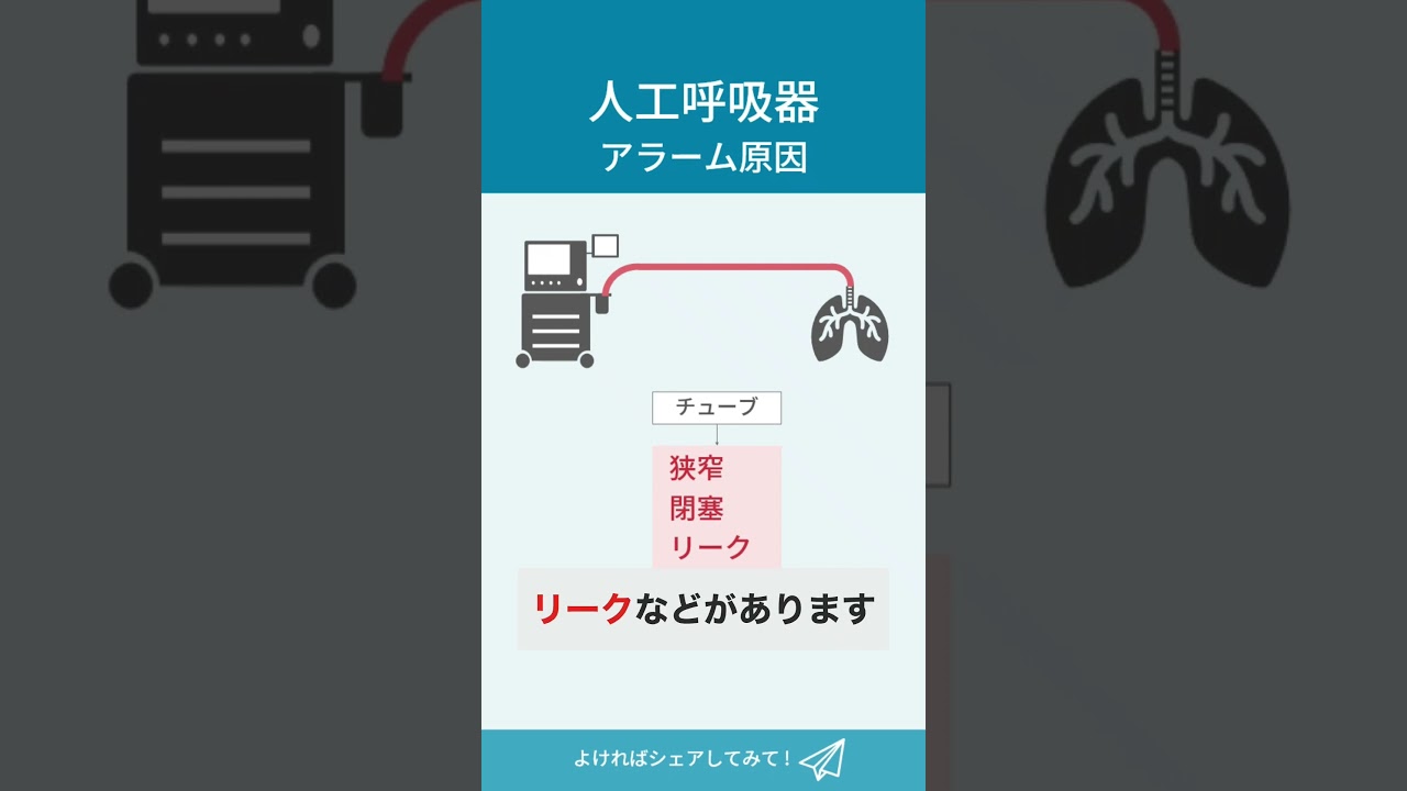 人工呼吸器のアラーム原因を理解するたった1つのコツ【呼吸器内科医が解説】