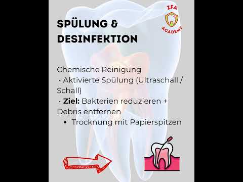 Wurzelkanalbehandlung: Ablauf & Schritte | Endo Basics für die ZFA Prüfung #prüfungsvorbereitung