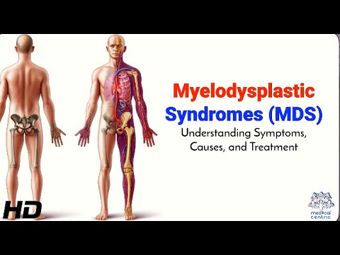 Myelodysplastic Syndromes (MDS): Symptoms, Diagnosis, and Treatment