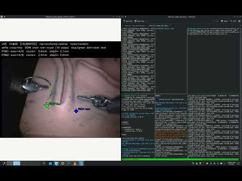 ResNet state-following dVRK trial