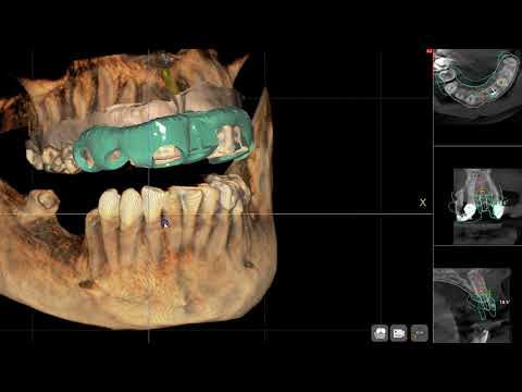 Digitally Guided Surgery
