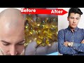 Fish Oil Benefits For Hair Fish Oil Benefits For Hair Growth BABA HEALTH CARE